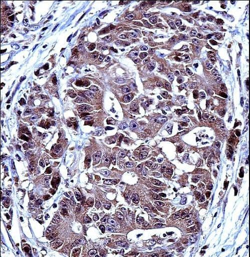 TS / Thymidylate Synthase Antibody (aa265-294)