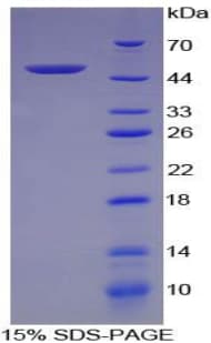 Rat FGF1 / Acidic FGF Protein (Recombinant His-GST)
