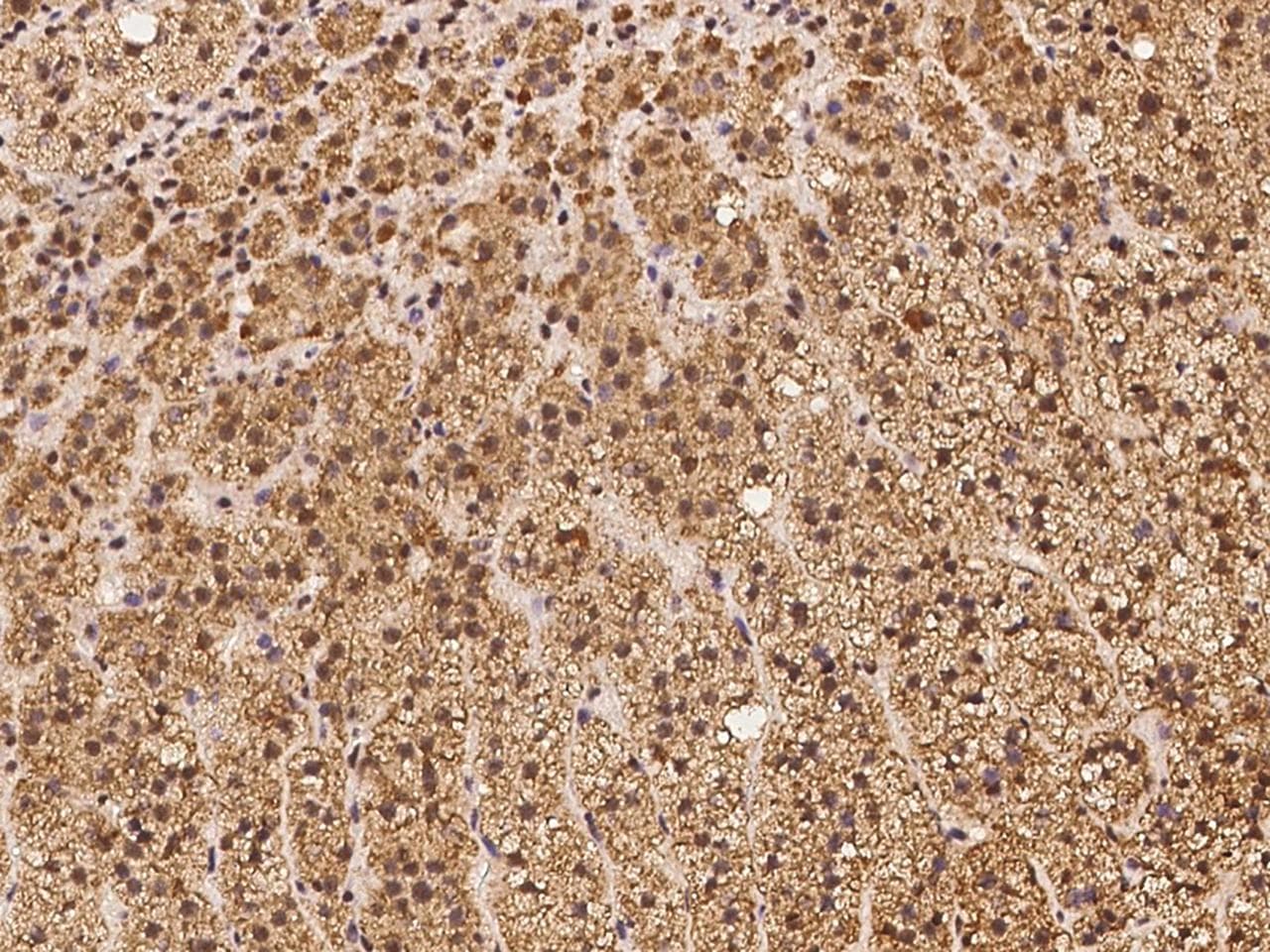 TIMM10B / FXC1 Antibody