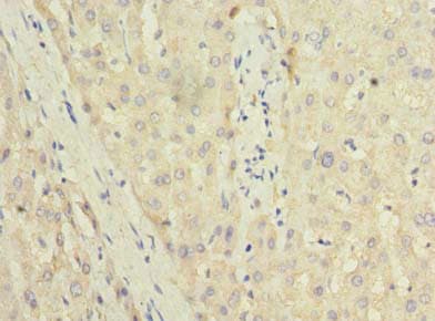 TRIT1 Antibody
