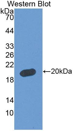 FBLN5 / Fibulin 5 Antibody (aa99-205)