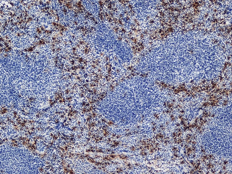 Ly-6B.2 Antibody (clone 7/4)