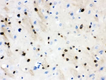Polyclonal Rabbit anti-Human STMN1 / Stathmin / LAG Antibody (IHC, WB)