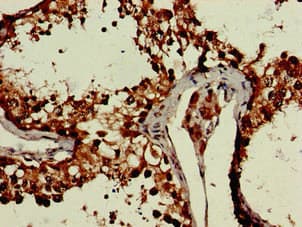CRCP / CGRP Receptor Component Antibody