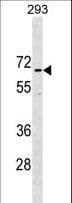 CCDC151 Antibody (aa18-46)