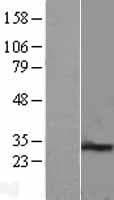 PEX11B Protein (Over-Expression Lysate Myc-DDK (Flag))