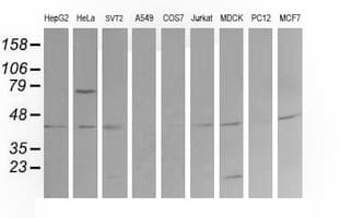 Monoclonal Mouse anti-Human MAP2K1 / MKK1 / MEK1 Antibody (clone OTI3E6, IHC, IF, WB)