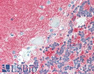 PathPlus™ Polyclonal Rabbit anti-Human NCAM / CD56 Antibody (aa759-858, IHC, WB)