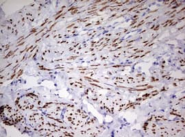 Monoclonal Mouse anti-Human PR / Progesterone Receptor Antibody (clone OTI2E2, aa1-298, IHC, WB)