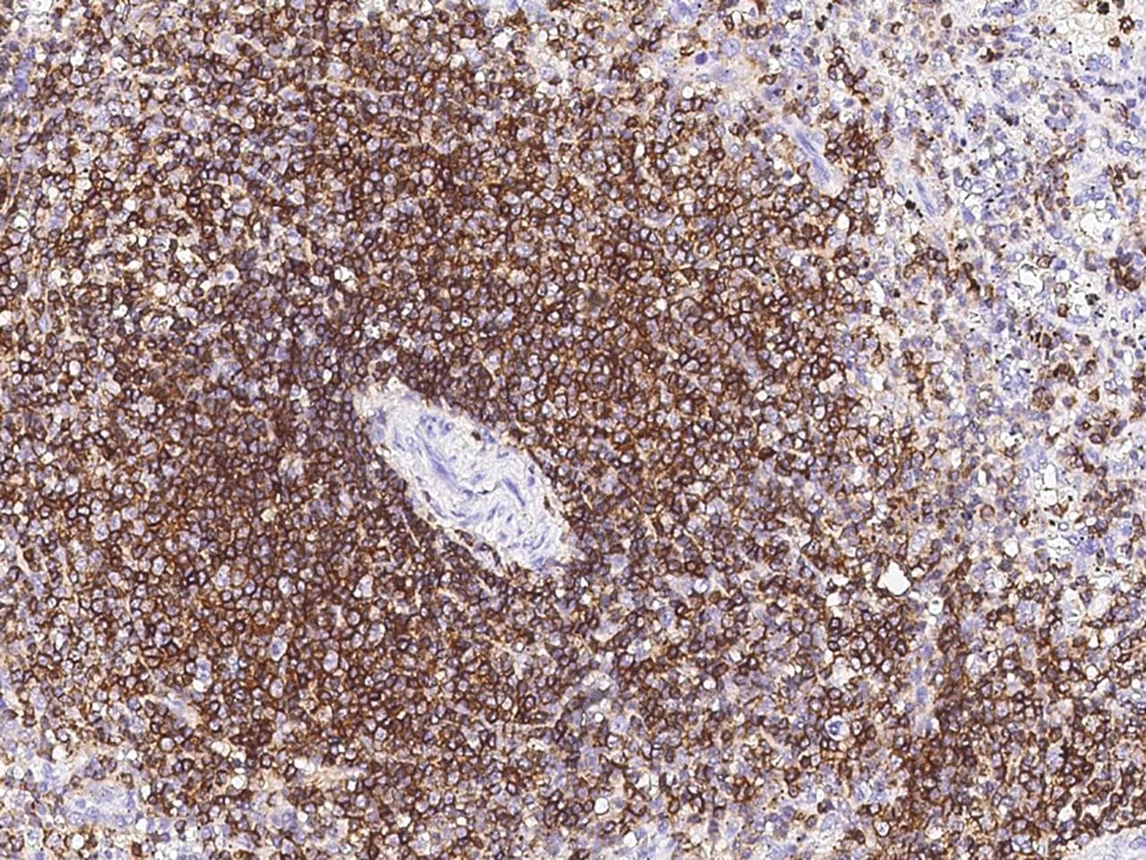 CD45 / LCA Antibody (clone 101, Preservative Free)