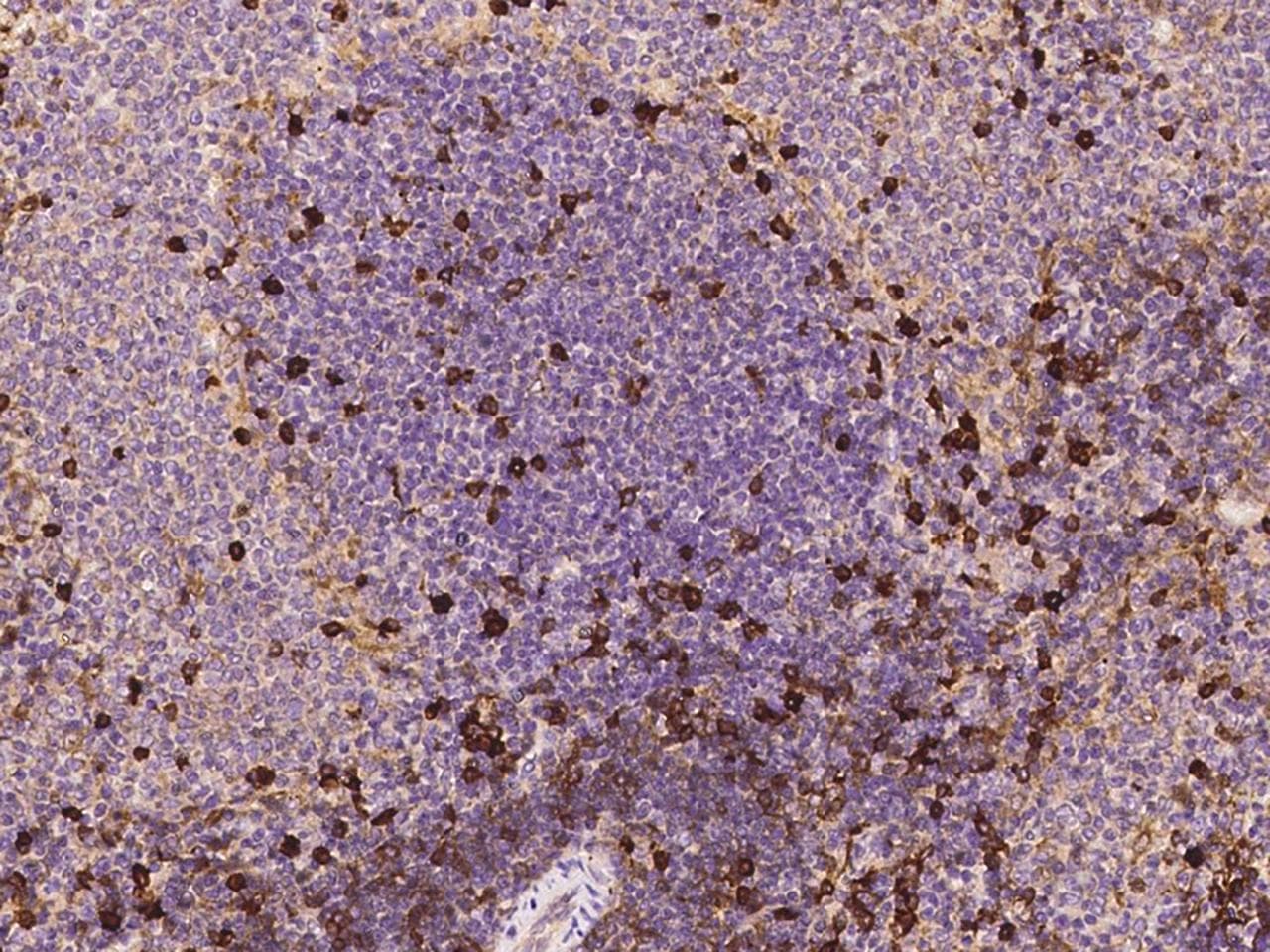 NT5E / eNT / CD73 Antibody (Preservative Free)