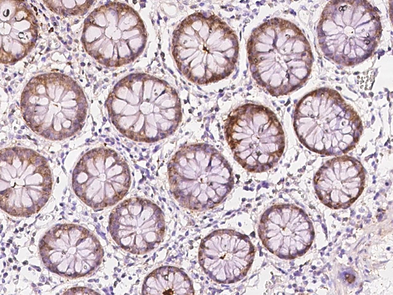 Polyclonal Rabbit anti-Human Selenium Binding Protein 1 Antibody (IHC)