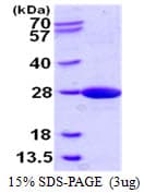 Human UBE2F Protein (Recombinant His)