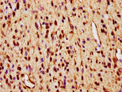 SMAD1 Antibody