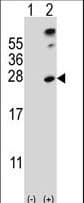 Polyclonal Rabbit anti-Human SENP8 Antibody (aa4-35, WB)
