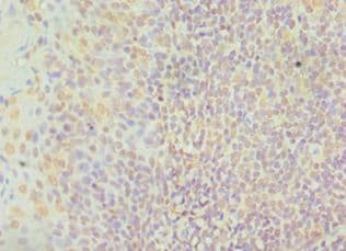 CTCF Antibody (aa1-260)