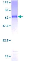 Human SIX2 Protein (Recombinant GST)