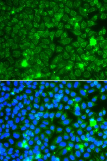 GBA3 / CBG Antibody