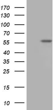 TBX20 Antibody (aa1-340, clone OTI2C7)