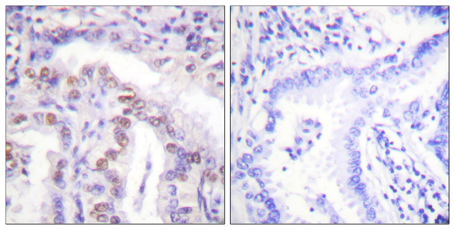 Polyclonal Rabbit anti-Human SENP6 Antibody (aa1042-1091, IHC)