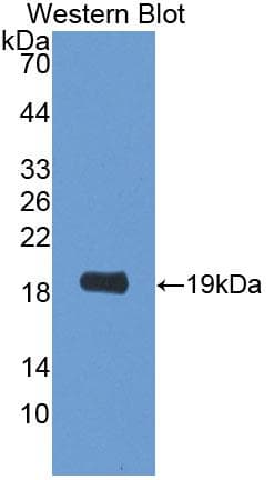 PLTP Antibody (aa337-479)