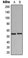 Polyclonal Rabbit anti-Human HARS Antibody (C-Terminus, IHC, IF, WB)