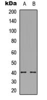 IHC-plus™ TROP2 / TACSTD2 Antibody (Internal)
