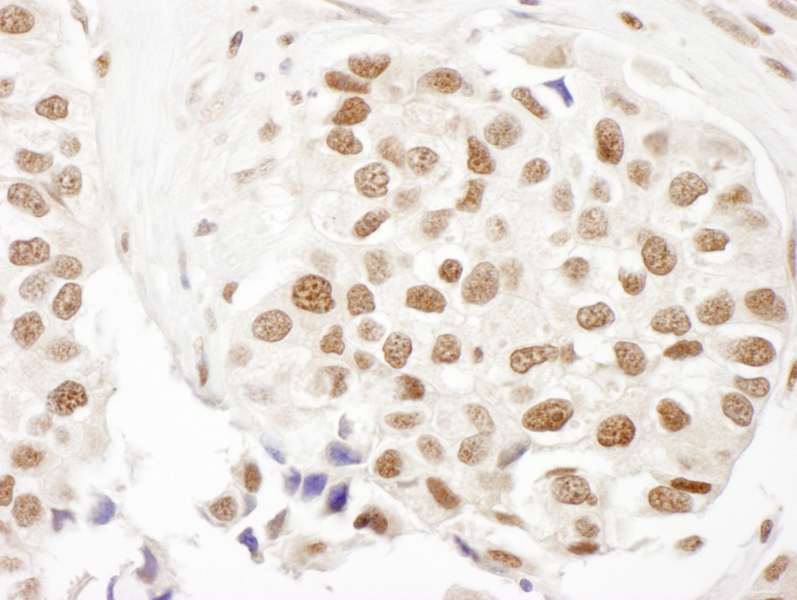 FANCD2 Antibody (aa1401-1451)
