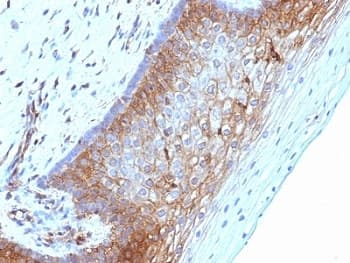 B2M / Beta 2 Microglobulin Antibody (clone B2M/1118)