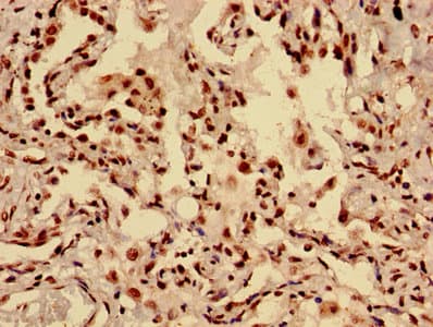 Polyclonal Rabbit anti-Human HIST1H3A Antibody (IHC, IF, WB)