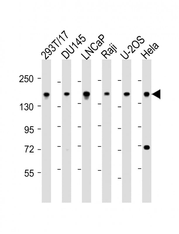PDS5B / AS3 Antibody (aa1197-1228)