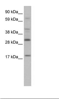 PYCARD / ASC / TMS1 Antibody (aa71-120)