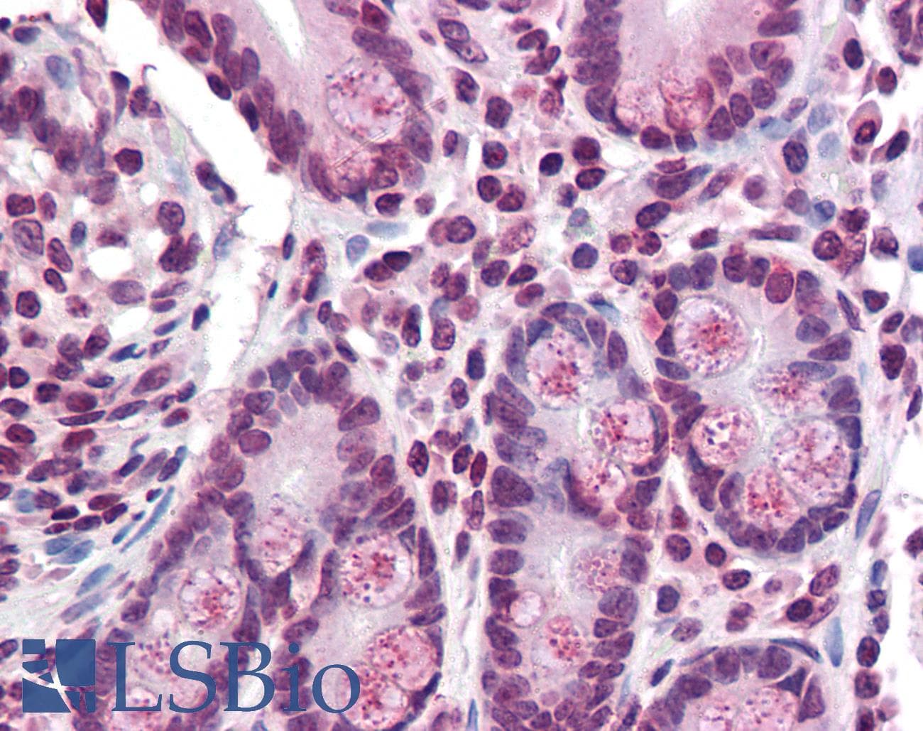 IHC-plus™ TMPRSS4 Antibody (Internal)