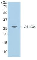 JAG1 / Jagged 1 Antibody (aa33-250, Biotin)