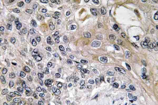 NTN1 / Netrin 1 Antibody (Gln533)