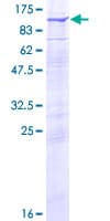 Human RHOBTB2 / DBC2 Protein (Recombinant GST)