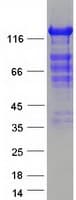 Human CARMA1 / CARD11 Protein (Recombinant Myc-DDK (Flag))