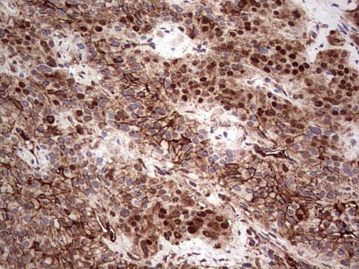 LGALS3 / Galectin 3 Antibody (clone OTI2F1)