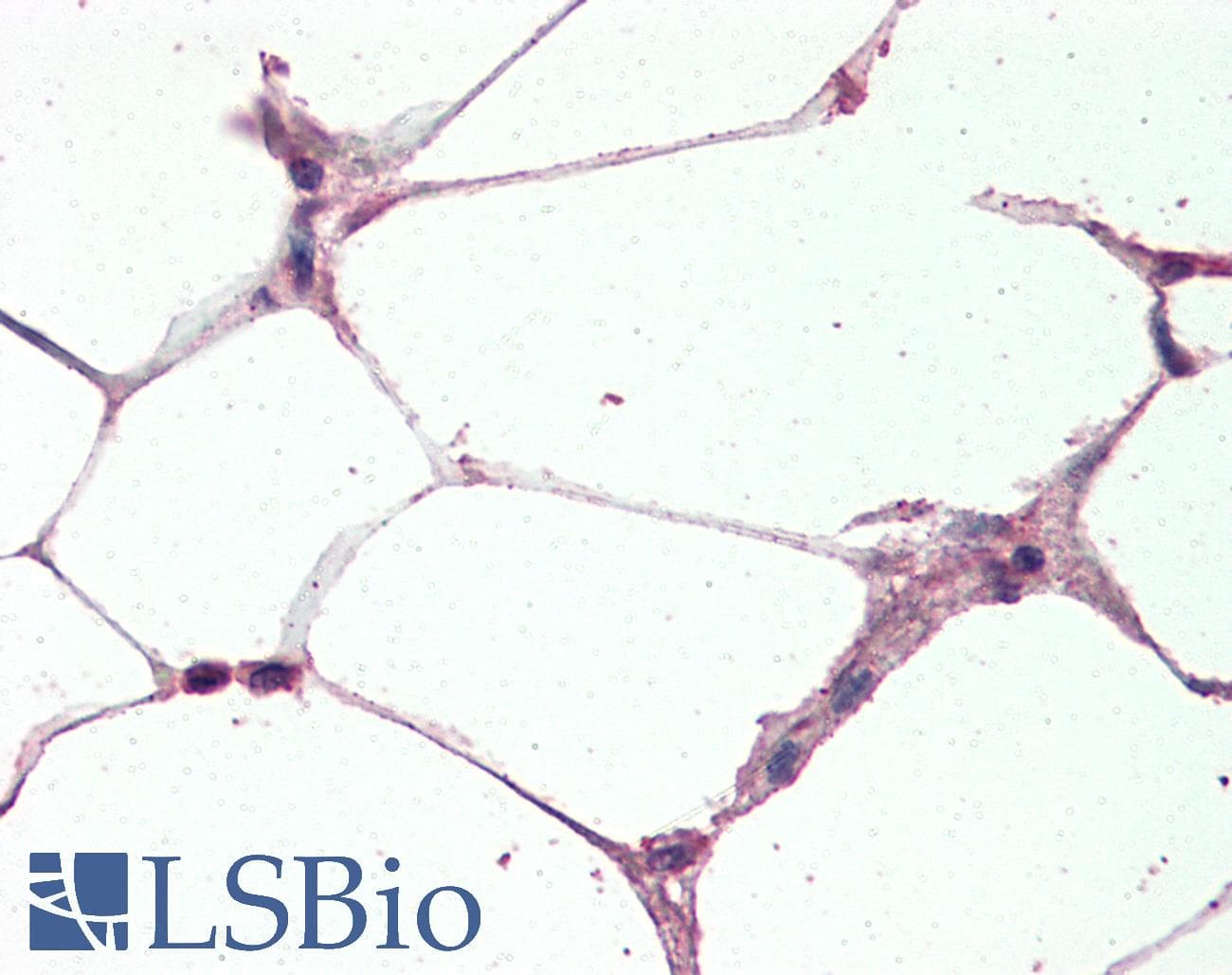 IHC-plus™ Polyclonal Goat anti-Human UCP2 Antibody (aa101-113, IHC, IF, WB)