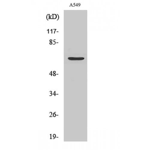 Polyclonal Rabbit anti-Human CHGA / Chromogranin A Antibody (Internal, IHC, WB)