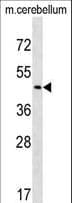 CHST2 Antibody (aa493-522)