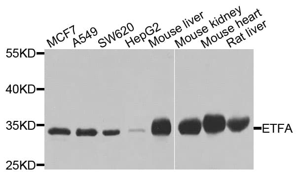 ETFA Antibody