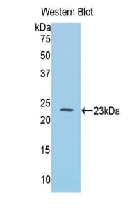 IL1RL1 Antibody (aa357-532, PE)