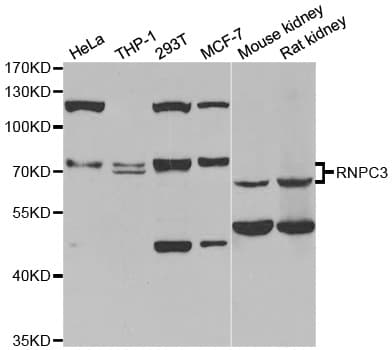 Polyclonal Rabbit anti-Human RBM40 / RNPC3 Antibody (IHC, WB)