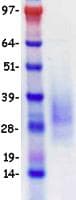 Human CD79A / CD79 Alpha Protein (Recombinant DDK (Flag)-His, C-terminus)