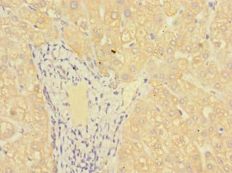 Polyclonal Rabbit anti-Human MR1 Antibody (IHC, IF, WB)