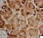 Monoclonal Mouse anti-Hepatitis B Virus HBV / HBsAg Antibody (clone A10F1, Ready-to-Use, IHC)