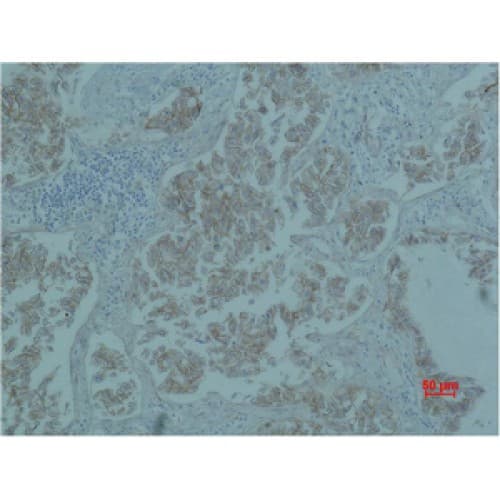 CTNNB1 / Beta Catenin Antibody (clone 4F2)