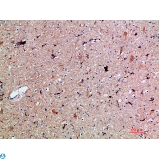 MED1 / TRAP220 Antibody