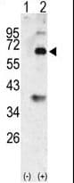 BMP3 Antibody (aa8-36)